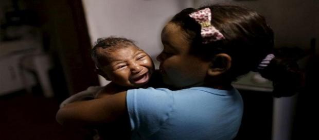 Zika vírus está relacionado à microcefalia em bebês Zika vírus está relacionado à microcefalia em bebês