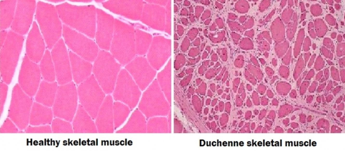 Medicina: è possibile rigenerare il tessuto muscolare