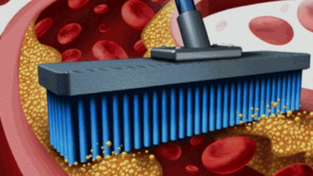 Innalzare il colesterolo HDL per rimuovere il colesterolo in eccesso.