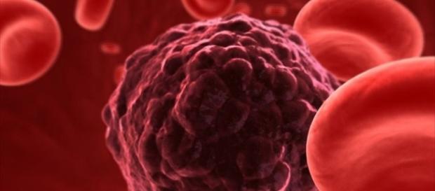 Afla ce boala ucide 10 românce in fiecare zi ... Afla ce boala ucide 10 românce in fiecare zi ...