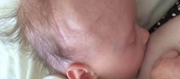 Mãe a amamentar filha bebé com cancro comove as redes sociais. Foto: Facebook Mãe a amamentar filha bebé com cancro comove as redes sociais. Foto: Facebook
