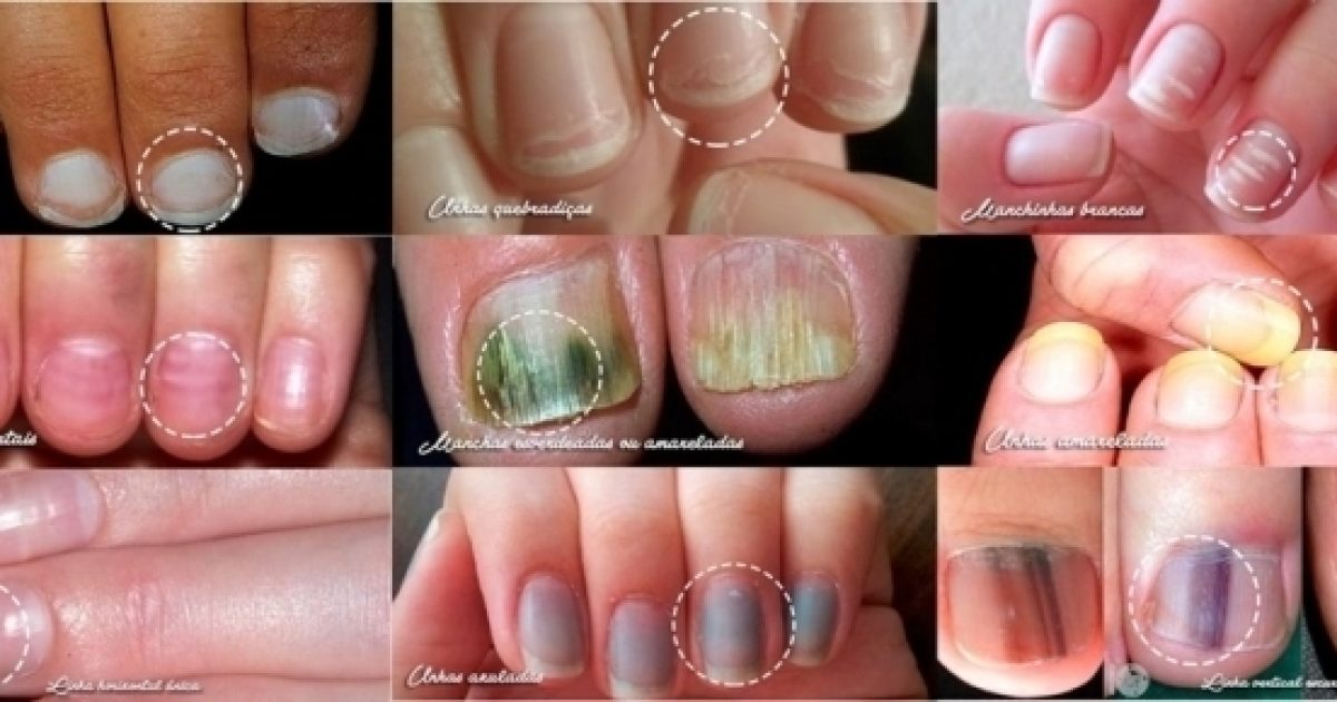 9 maneiras de reconhecer doenças através