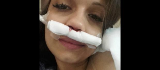 Débora Picoito foi operada aos adenoides Débora Picoito foi operada aos adenoides