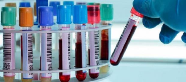 Nuevo análisis de sangre para saber el tratamiento contra la depresión Nuevo análisis de sangre para saber el tratamiento contra la depresión