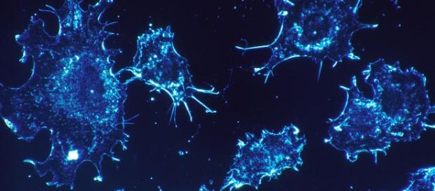 Células cancerígenas são destruídas mais facilmente com a imunoterapia Células cancerígenas são destruídas mais facilmente com a imunoterapia