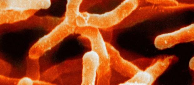 Image of Actinomyces bacteria. Courtesy of Wikipedia. Image of Actinomyces bacteria. Courtesy of Wikipedia.