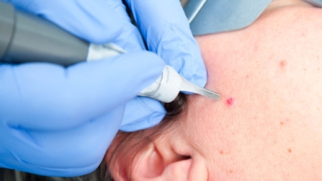 Prevenzione tumori: i 10 segnali da non sottovalutare | Benessere ... - leonardo.it