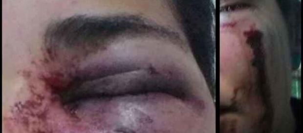 Mayra foi agredida com dois socos por simpatizante de Bolsonaro Mayra foi agredida com dois socos por simpatizante de Bolsonaro