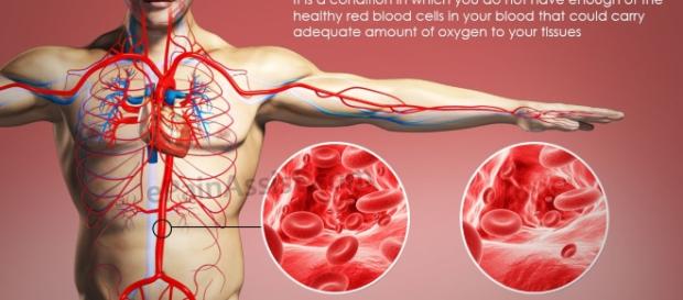 ANEMIA, GLOBULOS ROJOS, ANALIZANDO ANEMIA, GLOBULOS ROJOS, ANALIZANDO