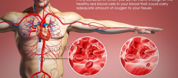 Eritrocitos en sangre, disminución Eritrocitos en sangre, disminución