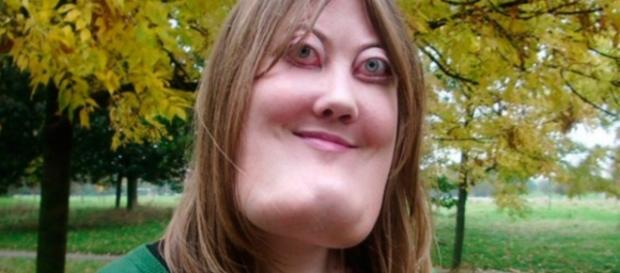 Rosto de mulher é considerado quatro ou cinco vezes maior que o tamanho de um rosto comum. Rosto de mulher é considerado quatro ou cinco vezes maior que o tamanho de um rosto comum.