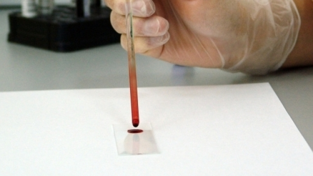 Approvata legge per lo screening neonatale di 40 malattie rare - Credits: PublicDomainPictures