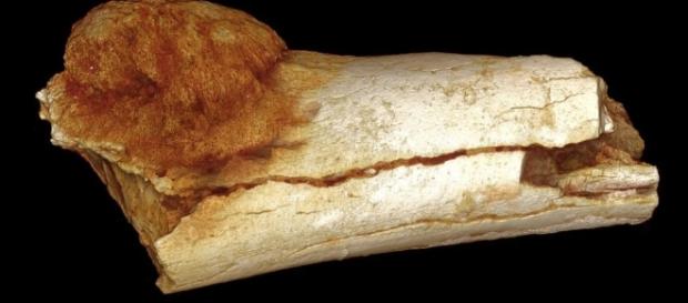 1.7 million-year-old cancer found, the oldest yet | Colorado ... - gazette.com 1.7 million-year-old cancer found, the oldest yet | Colorado ... - gazette.com