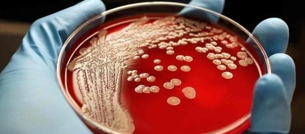 Bactéria MRSA (foto) resiste a vários antibióticos (R Parulan Jr.) Bactéria MRSA (foto) resiste a vários antibióticos (R Parulan Jr.)