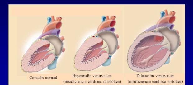 Insuficiencia cardiaca. DEFINICION Situación en la cual el corazón ... - slideplayer.es Insuficiencia cardiaca. DEFINICION Situación en la cual el corazón ... - slideplayer.es