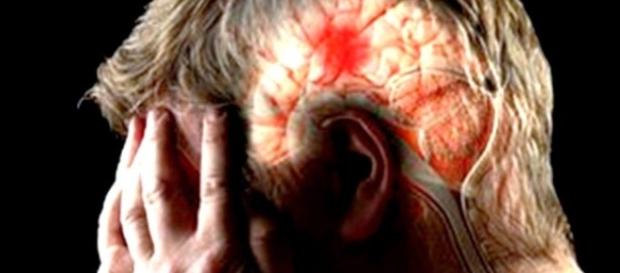 Conoces los síntomas de un derrame cerebral? Conoces los síntomas de un derrame cerebral?
