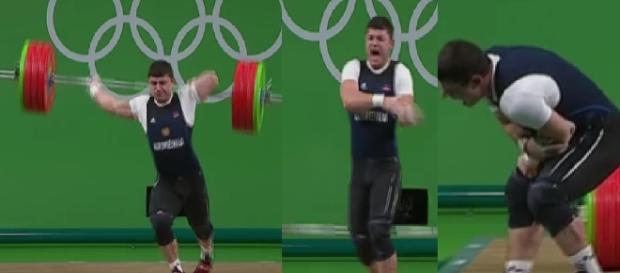 Atleta quebra o braço e reclama de forte dor Atleta quebra o braço e reclama de forte dor