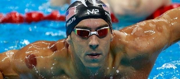 Descubra o que são as manchas vermelhas no corpo do nadador Michael Phelps. Descubra o que são as manchas vermelhas no corpo do nadador Michael Phelps.