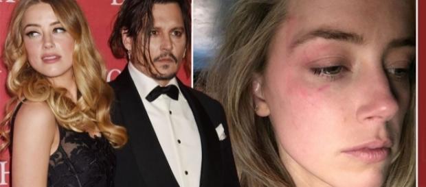 Amber Heard divulgou foto de seu rosto após suposta agressão Amber Heard divulgou foto de seu rosto após suposta agressão
