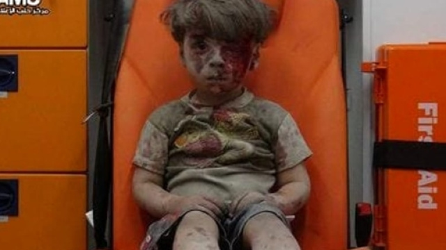 Siria, Aleppo: bambino ferito nei bombardamenti | Foto e Video - today.it