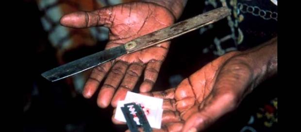 Instrumentos utilizados na mutilação genital de meninas Instrumentos utilizados na mutilação genital de meninas