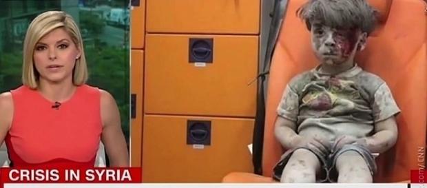 Podczas gdy spikerka telewizji CNN zalała się łzami nad losem Omrana, telewizja Rasija demaskuje autora reportażu na jego temat (opis galerii zdjęć). Podczas gdy spikerka telewizji CNN zalała się łzami nad losem Omrana, telewizja Rasija demaskuje autora reportażu na jego temat (opis galerii zdjęć).