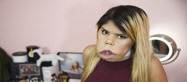 Marimar tem uma condição rara de saúde, apesar disso, dá uma aula de autoestima Marimar tem uma condição rara de saúde, apesar disso, dá uma aula de autoestima