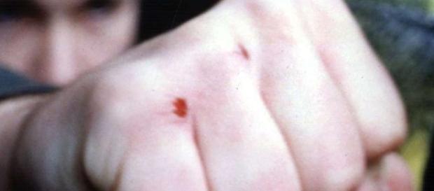 Vorsicht - Zuzuschlagen kann auch für Opfer folgen haben! Vorsicht - Zuzuschlagen kann auch für Opfer folgen haben!
