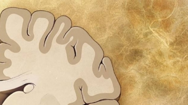 La neuregulina-1 protegge il cervello dall'Alzheimer