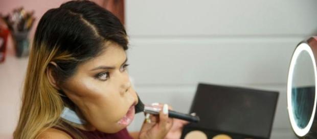 Esta chica con un tumor facial quiere cambiar el concepto de belleza. Esta chica con un tumor facial quiere cambiar el concepto de belleza.