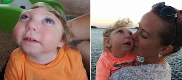 Jaxon și mama lui au sărbătorit a doua aniversare a zilei de naștere deși nimeni nu le dădea nici o șansă - Foto: Facebook Jaxon și mama lui au sărbătorit a doua aniversare a zilei de naștere deși nimeni nu le dădea nici o șansă - Foto: Facebook