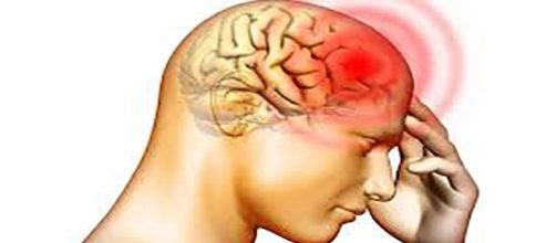 La meningite è una malattia subdola perché all'inizio è facile scambiarla per una banale cefalea.