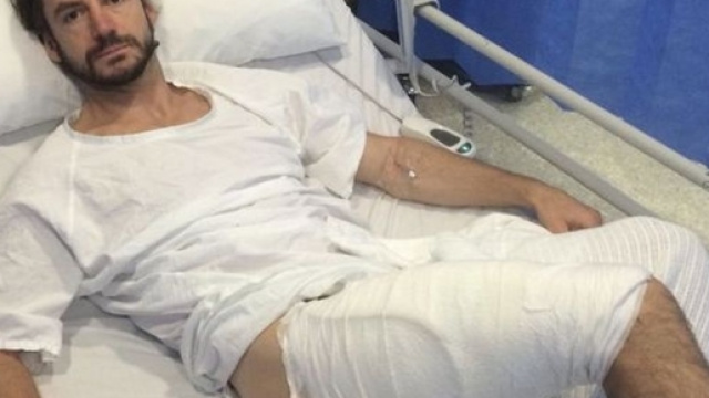 iPhone scoppia in tasca: ciclista ustionato