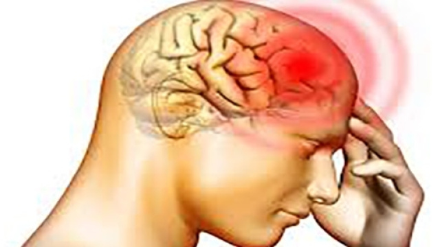 La meningite è una malattia subdola perché all'inizio è facile scambiarla per una banale cefalea.