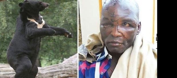 Imagens de indiano atacado por urso enquanto trabalhava em sua propriedade. Imagens de indiano atacado por urso enquanto trabalhava em sua propriedade.