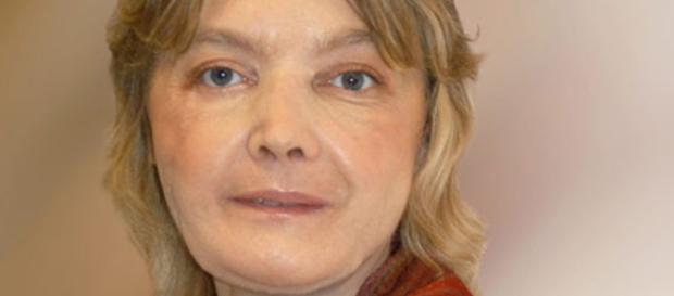 Isabelle Dinoire: la prima donna a ricevere un trapianto di faccia Isabelle Dinoire: la prima donna a ricevere un trapianto di faccia