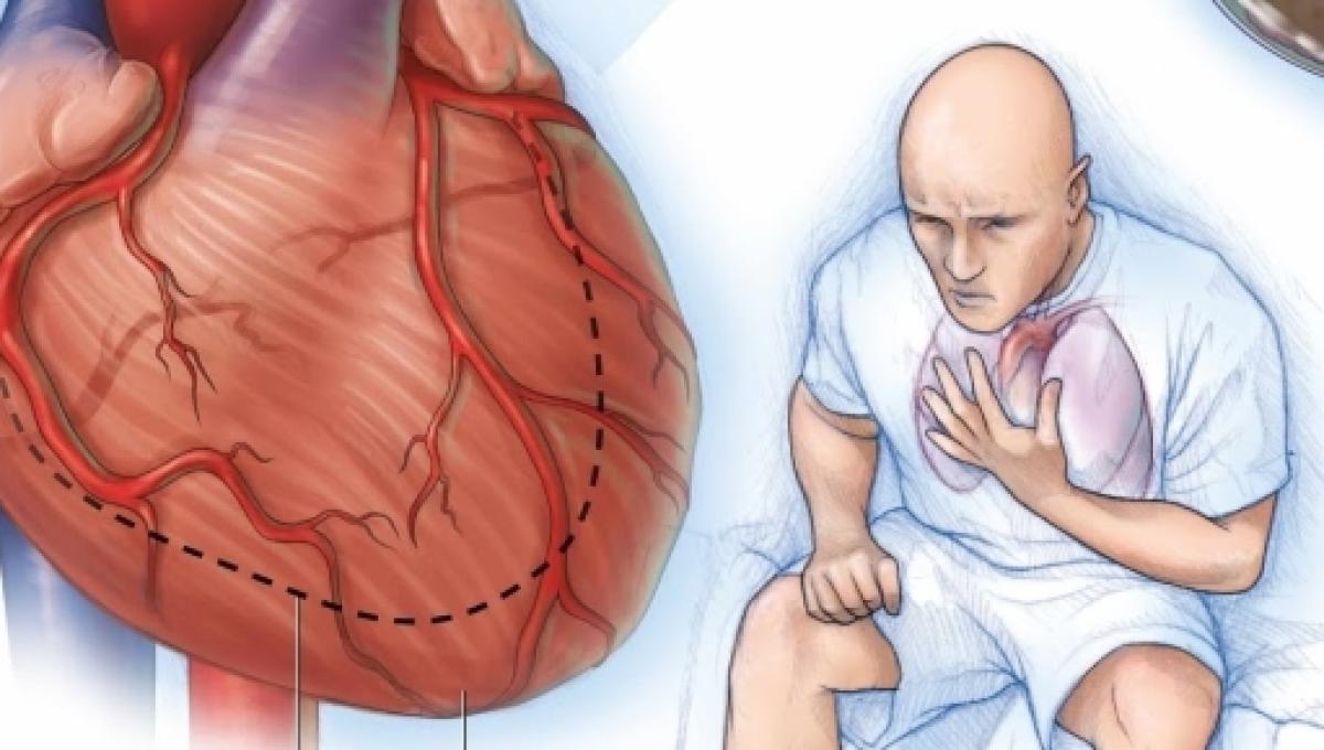 CLASIFICACION FISIOPATOLOGICA DE LA INSUFICIENCIA CARDIACA