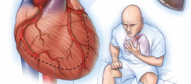Centro de Salud Profesor Jesús Marín: Insuficiencia cardiaca ... - csjesusmarin.es Centro de Salud Profesor Jesús Marín: Insuficiencia cardiaca ... - csjesusmarin.es