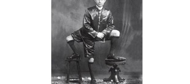 Francesco Lentini, il siciliano con tre gambe Francesco Lentini, il siciliano con tre gambe
