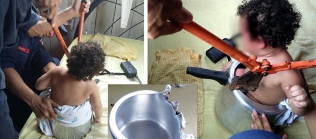 Acre: Criança usa panela de pressão como brinquedo e fica presa ... - http://mundoconectado.net/noticias/bebe-fica-presa-em-panela-de-pressao/ Acre: Criança usa panela de pressão como brinquedo e fica presa ... - http://mundoconectado.net/noticias/bebe-fica-presa-em-panela-de-pressao/