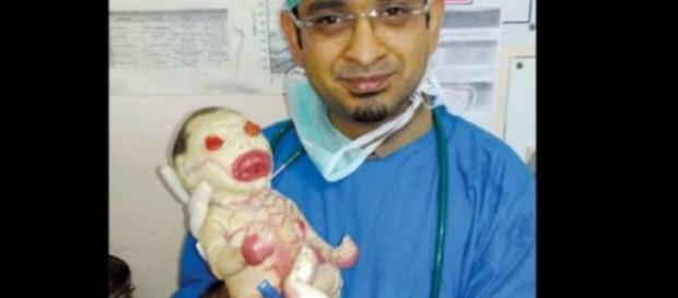 Médico indiano com bebê portador da enfermidade Médico indiano com bebê portador da enfermidade