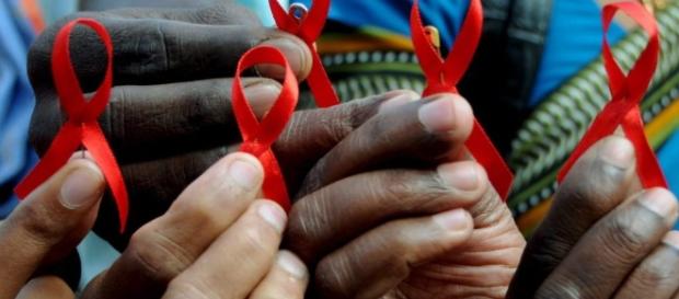 El VIH-SIDA y la cura en la variacion genetica El VIH-SIDA y la cura en la variacion genetica