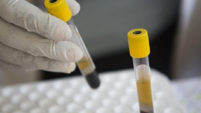 Hiv: untore di Roma rischia grosso