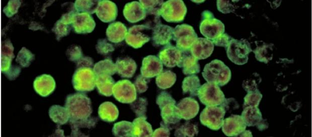 La bacteria come-cerebros es fácil de encontrar en el entorno La bacteria come-cerebros es fácil de encontrar en el entorno
