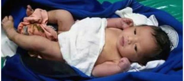 Bebê foi encontrada junto da lixeira Bebê foi encontrada junto da lixeira