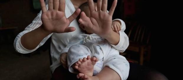 Mãe e filho tem dedos a mais nos pés e nas mãos. Mãe e filho tem dedos a mais nos pés e nas mãos.