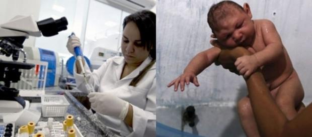 Conheça as outras complicações em bebês, ligadas a microcefalia Conheça as outras complicações em bebês, ligadas a microcefalia