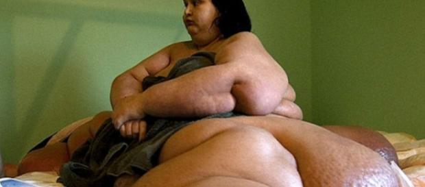 Mulher mais gorda do mundo perde 395 quilos - areademulher.com Mulher mais gorda do mundo perde 395 quilos - areademulher.com