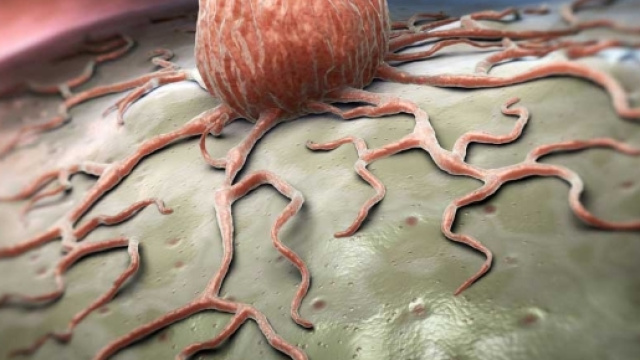 Tumori, 1000 nuovi casi al giorno: aumentano tra le donne e diminuiscono negli uomini