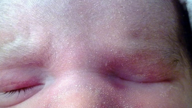 Bambino senza occhi in Cina: madre avvilita